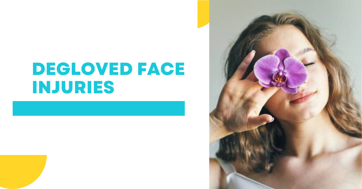 Degloved Face Injuries: A Comprehensive Guide